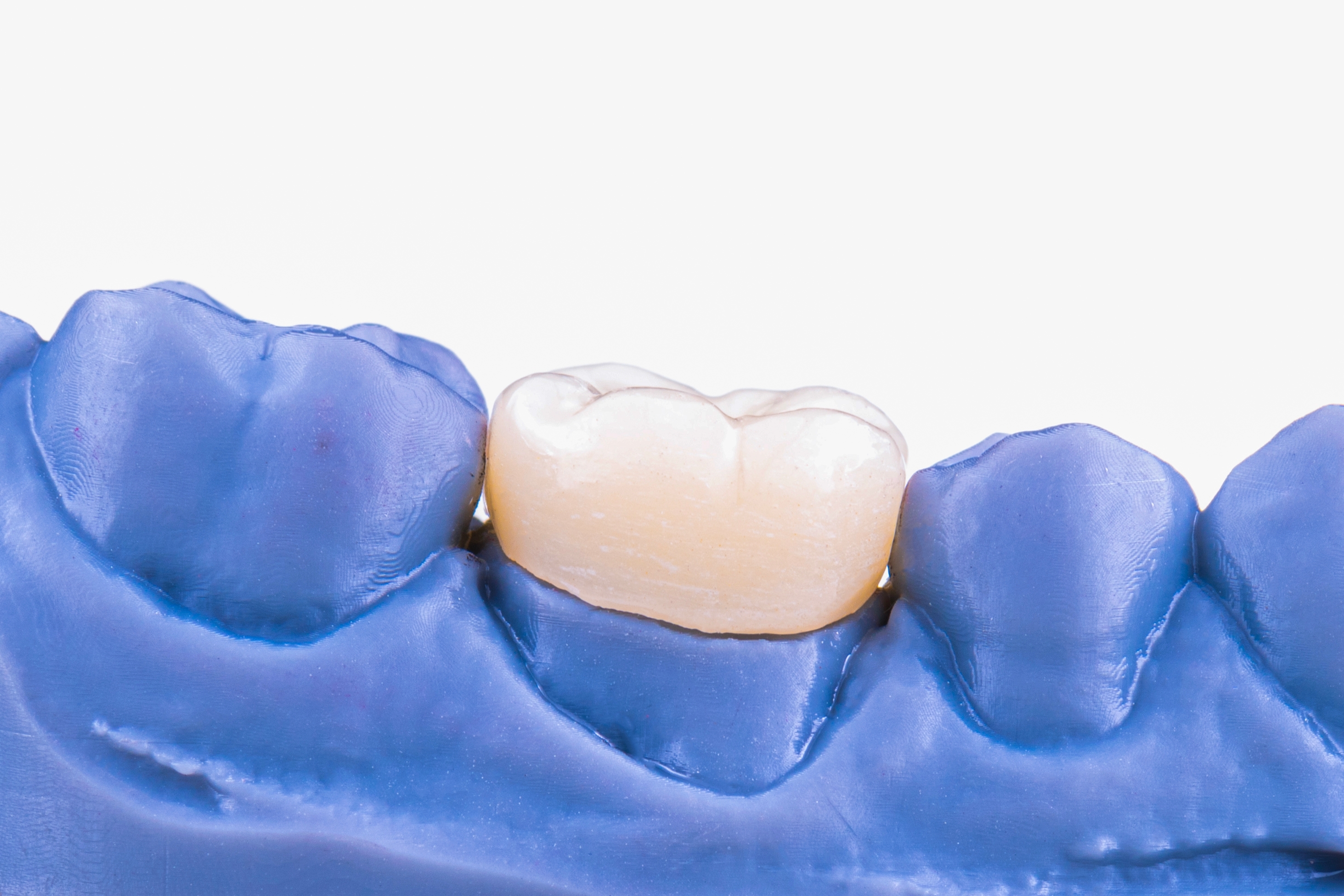 Новый аппарат Air Flow для бережной чистки зубов