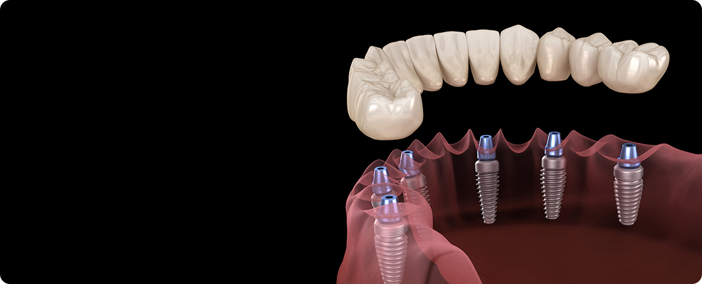 services-slider-card