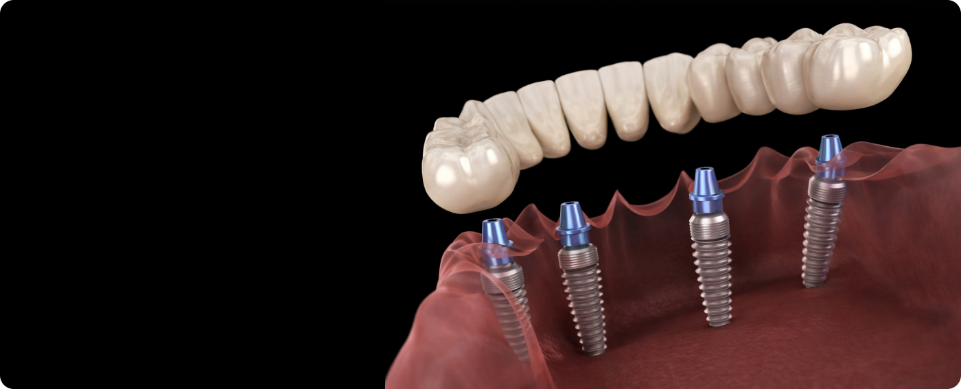 services-slider-card