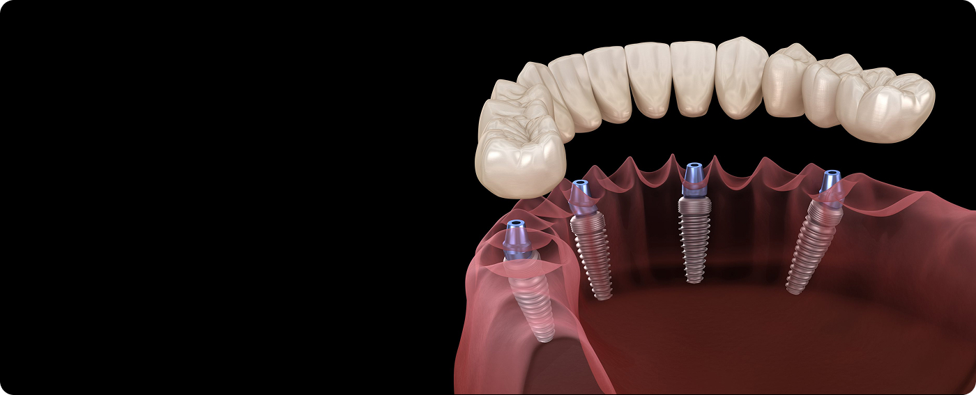 services-slider-card