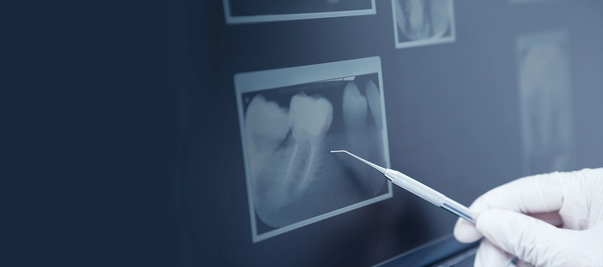 services-slider-card