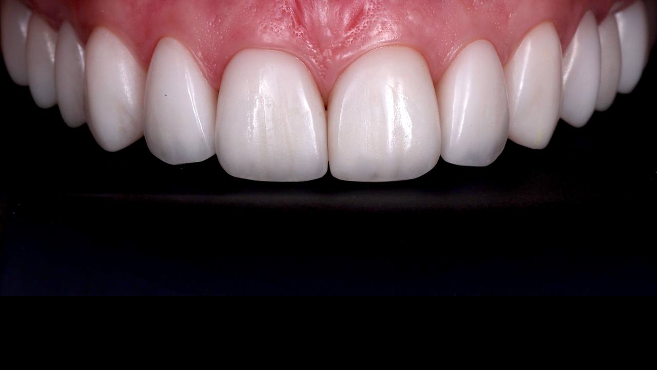 Услуга детальная