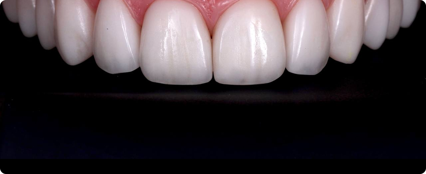 services-slider-card