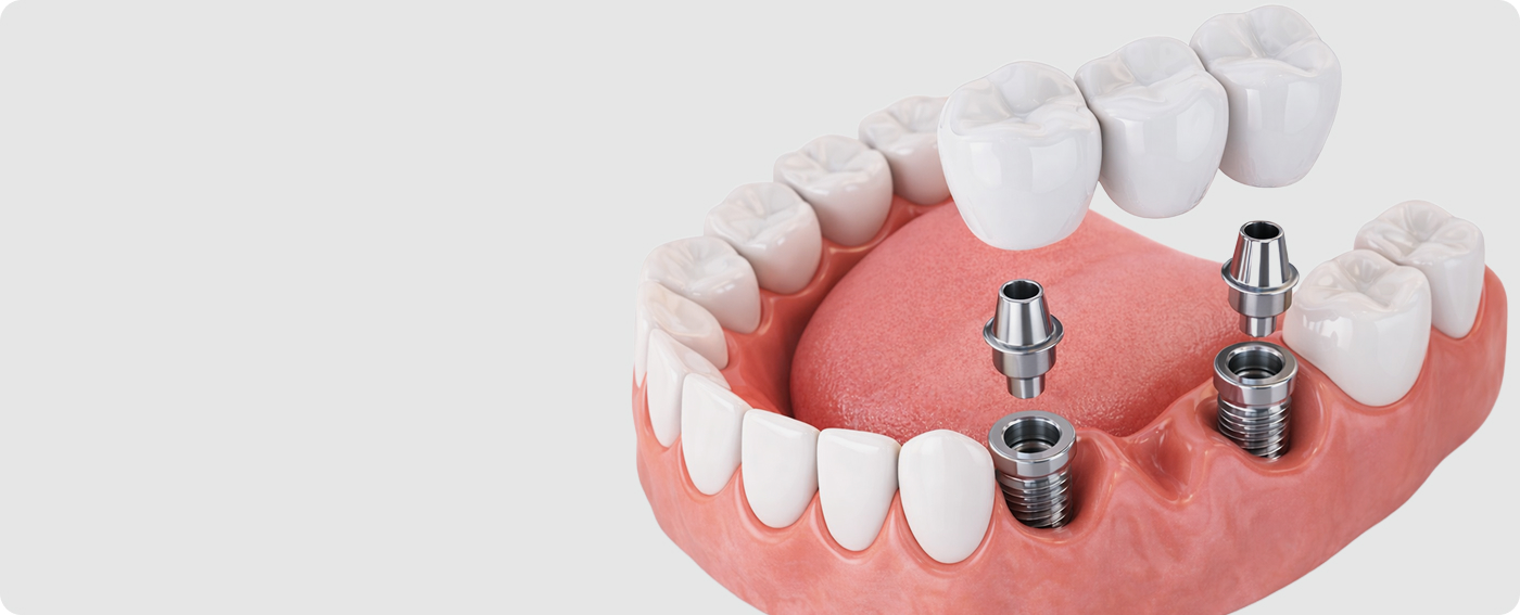 Услуга детальная