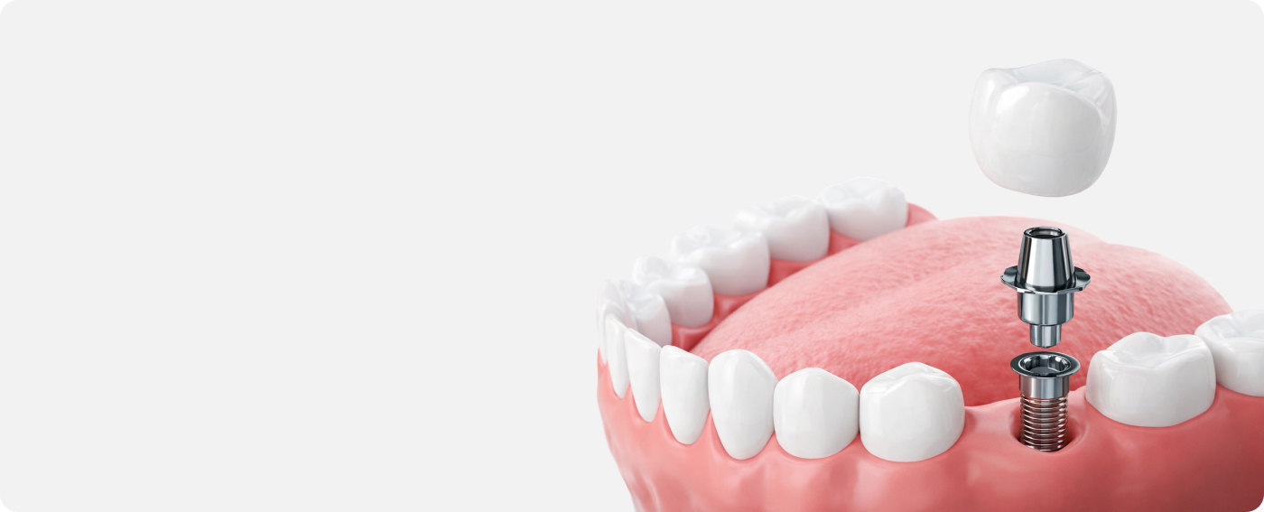 services-slider-card