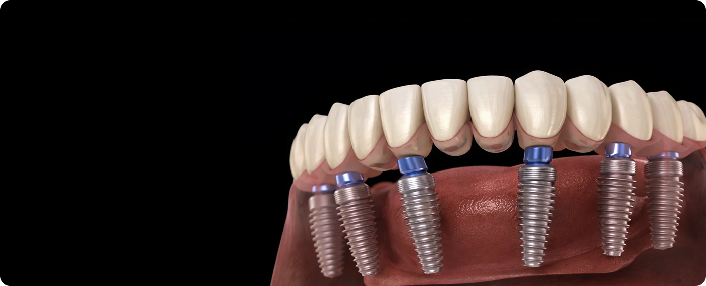 services-slider-card