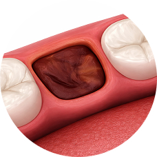 Простое удаление