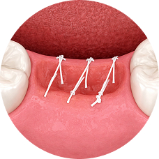 Сложное удаление