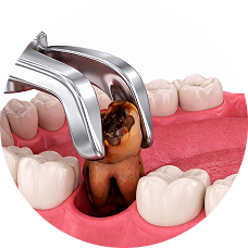 Простое удаление