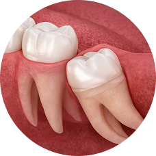 Сложное удаление