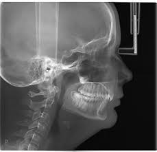 Безопасно: доза облучения в 10 раз ниже  стандартных томографов