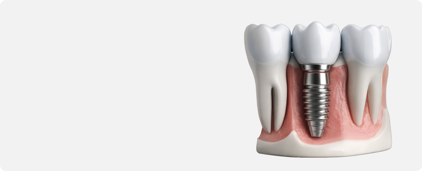 services-slider-card