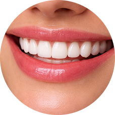 Полевошпатная керамика (рефракторная техника)