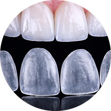 Керамика E-max