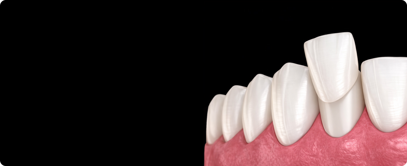 Услуга детальная