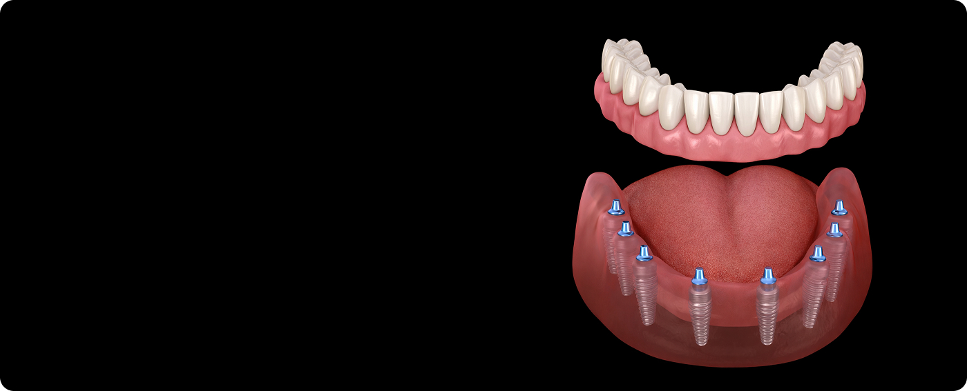 Услуга детальная
