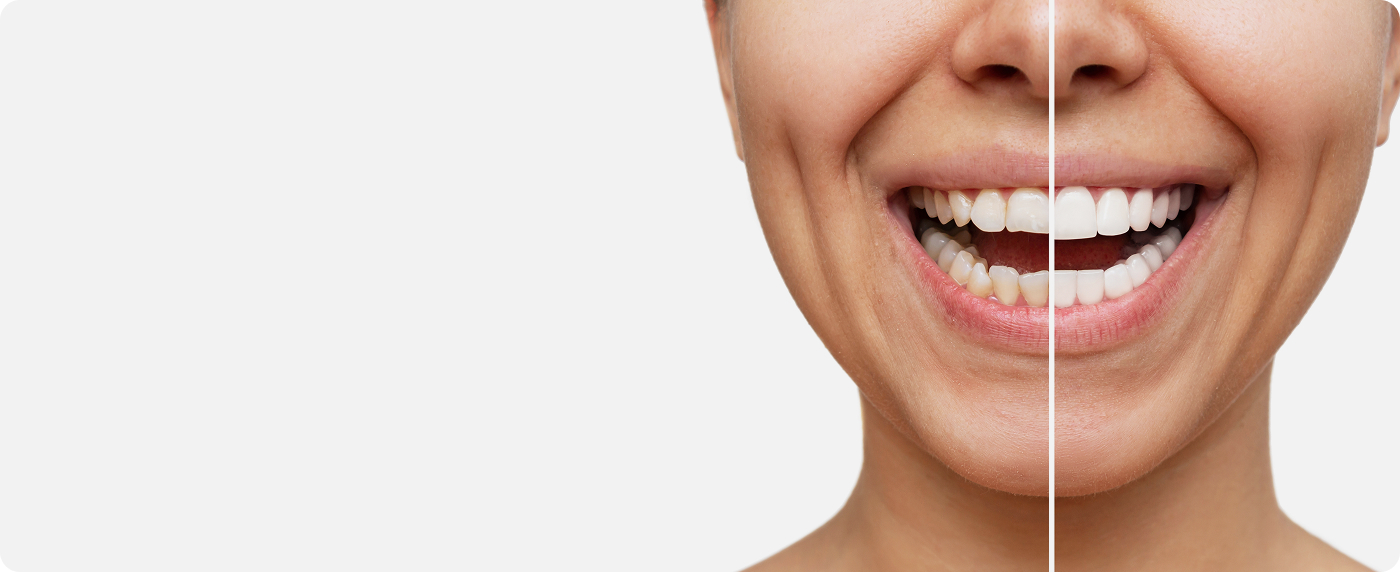 services-slider-card